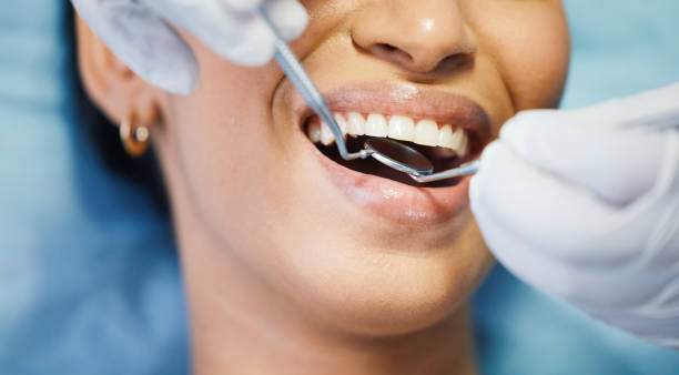 Best Emergency Dentist for Knocked-Out Tooth in Wenatchee, WA